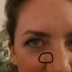 Image of a woman with a dark spot on her face circled